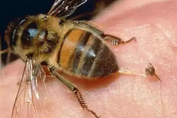 蜂毒在人体能存在多久，一般3-4天就会被代谢掉