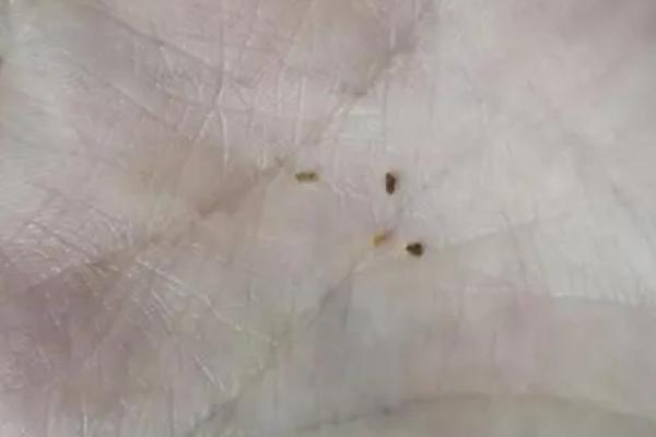 跳蚤的灭杀方法，用敌敌畏兑水喷雾可有效清除