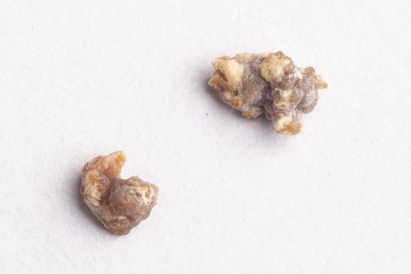 狗得了结石怎么办，结石较小且症状不严重可选择药物治疗