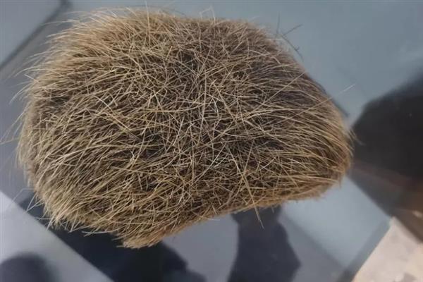 猪宝是什么,是指猪胆囊等器官中的结石