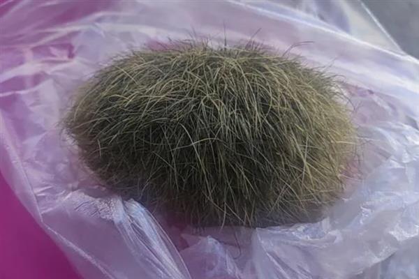 猪宝是什么,是指猪胆囊等器官中的结石