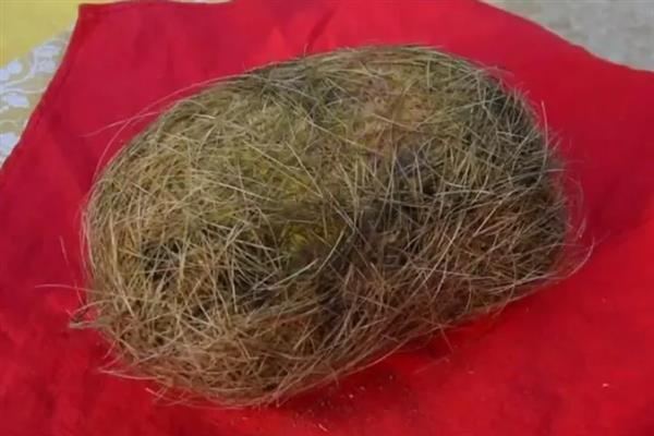 猪宝是什么,是指猪胆囊等器官中的结石