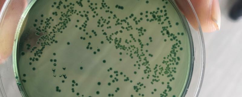 绿弧菌与黄弧菌哪个有害，绿弧菌的危害要大一点