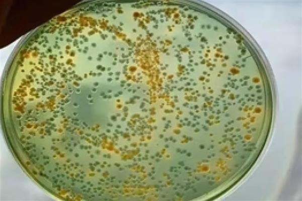 绿弧菌与黄弧菌哪个有害，绿弧菌的危害要大一点