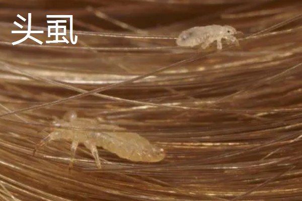 虱子的种类，有体虱、头虱和阴虱