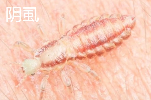 虱子的种类，有体虱、头虱和阴虱