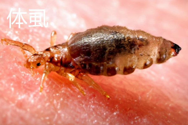 虱子的种类，有体虱、头虱和阴虱