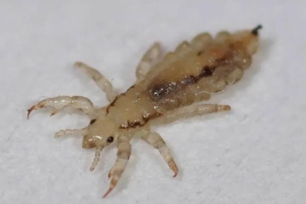 虱子的种类，有体虱、头虱和阴虱