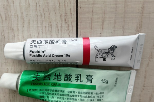 被隐翅虫咬后擦什么药,可以擦地奈德乳膏等