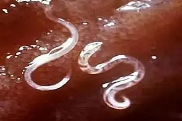 养狗要注意哪些寄生虫，要注意弓首蛔虫、钩虫等