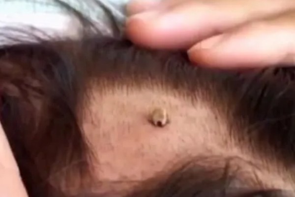 如何驱除狗狗身上的蜱虫，可使用宠物体外驱虫药