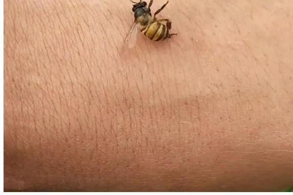被蜜蜂蛰了是不是鸿运当头的征兆,属于迷信说法被蛰后应尽快处理
