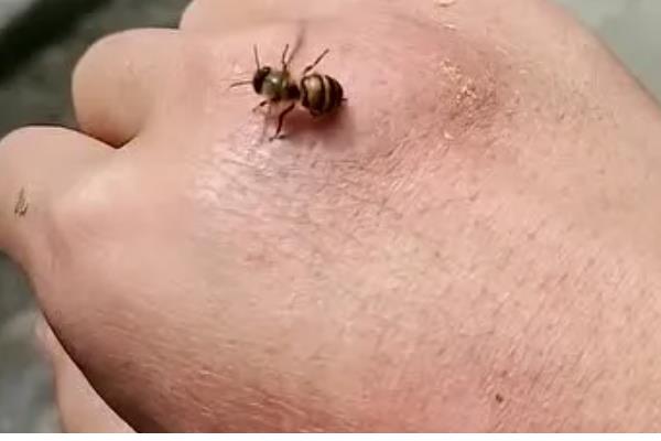 被蜜蜂蛰了是不是鸿运当头的征兆,属于迷信说法被蛰后应尽快处理