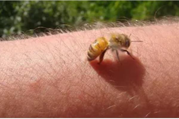 被蜜蜂蛰了是不是鸿运当头的征兆,属于迷信说法被蛰后应尽快处理
