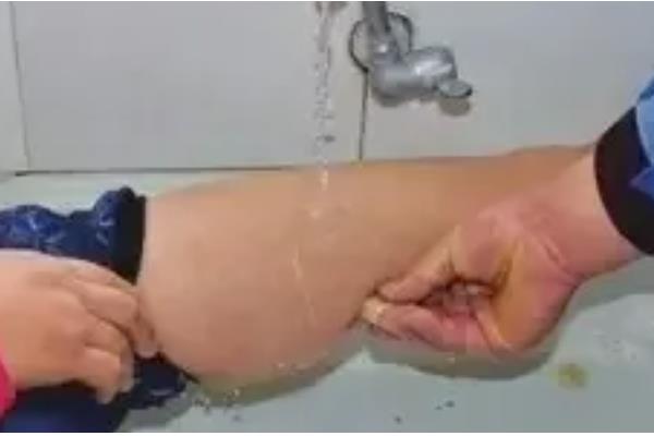 五步蛇的名称由来,有以下3种解释