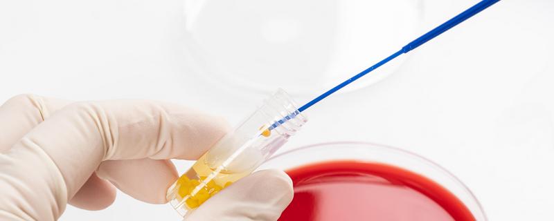 菌种传代的操作规程,菌种管在前接种管在后