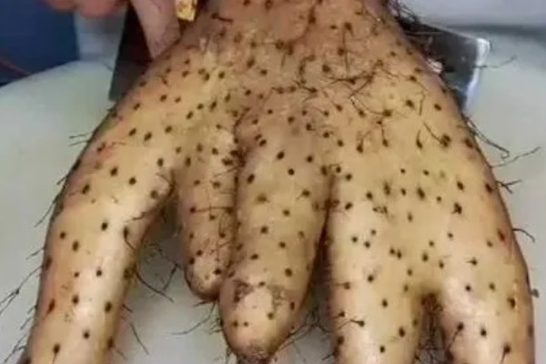 山药畸形是什么原因，可能是土壤中有硬物所致